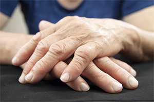 Arthritis Pain Relief