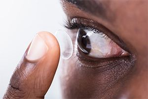 Contact Lenses